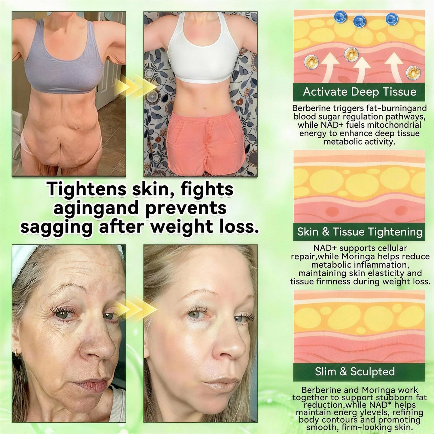𝑶𝒇𝒇𝒊𝒄𝒊𝒂𝒍 𝒔𝒕𝒐𝒓𝒆  | Surgoᴎix®🚀 𝐌𝐨𝐫𝐢𝐧𝒈𝗮 𝑩𝒆𝒓𝒃𝒆𝐫𝐢𝐧𝐞𝐱 𝐍𝗔𝒟+ 10-𝑖n-1 𝐍a𝒏𝒐 𝐌𝐢𝐜𝐫𝑜𝑛𝑒𝑒𝗱𝗹𝗲 𝐏𝐚𝒕𝒄𝒉(𝐉𝐮𝐬𝐭 𝐨𝐧𝐜𝐞 𝐚 𝐝𝐚𝐲, 𝐯𝐢𝐬𝐢𝐛𝐥𝐞 𝐜𝐡𝐚𝐧𝐠𝐞𝐬 𝐢𝐧 𝟕 𝑫𝐚𝐲𝐬） 𝐅𝐨𝐫 𝐎𝐛𝐞𝐬𝐢𝐭𝐲,  𝙇𝙊𝙊𝙎𝗘 𝗦𝗞𝗜𝗡,𝐝𝐢𝐚𝐛𝐞𝐭𝙚𝙨, 𝐬𝐥𝐞𝐞𝐏 𝐚𝐩𝐧𝐞𝐚, 𝐣𝐨𝐢𝐧𝐭 𝐢𝐬𝐬𝐮𝙚𝙨, 𝐚𝐧𝐝 𝐦𝐨𝐫𝐞 ⚡