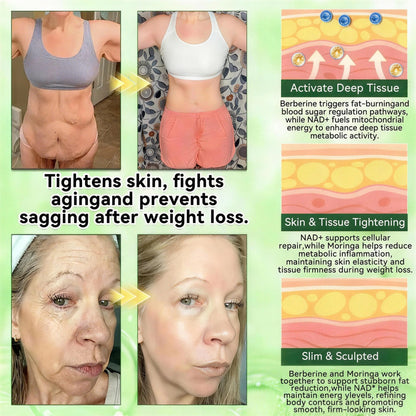 𝑶𝒇𝒇𝒊𝒄𝒊𝒂𝒍 𝒔𝒕𝒐𝒓𝒆  | Surgoᴎix®🚀 𝐌𝐨𝐫𝐢𝐧𝒈𝗮 𝑩𝒆𝒓𝒃𝒆𝐫𝐢𝐧𝐞𝐱 𝐍𝗔𝒟+ 10-𝑖n-1 𝐍a𝒏𝒐 𝐌𝐢𝐜𝐫𝑜𝑛𝑒𝑒𝗱𝗹𝗲 𝐏𝐚𝒕𝒄𝒉(𝐉𝐮𝐬𝐭 𝐨𝐧𝐜𝐞 𝐚 𝐝𝐚𝐲, 𝐯𝐢𝐬𝐢𝐛𝐥𝐞 𝐜𝐡𝐚𝐧𝐠𝐞𝐬 𝐢𝐧 𝟕 𝑫𝐚𝐲𝐬） 𝐅𝐨𝐫 𝐎𝐛𝐞𝐬𝐢𝐭𝐲,  𝙇𝙊𝙊𝙎𝗘 𝗦𝗞𝗜𝗡,𝐝𝐢𝐚𝐛𝐞𝐭𝙚𝙨, 𝐬𝐥𝐞𝐞𝐏 𝐚𝐩𝐧𝐞𝐚, 𝐣𝐨𝐢𝐧𝐭 𝐢𝐬𝐬𝐮𝙚𝙨, 𝐚𝐧𝐝 𝐦𝐨𝐫𝐞 ⚡